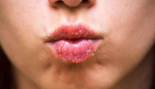 Beetroot Lip & Cheeks Scrub